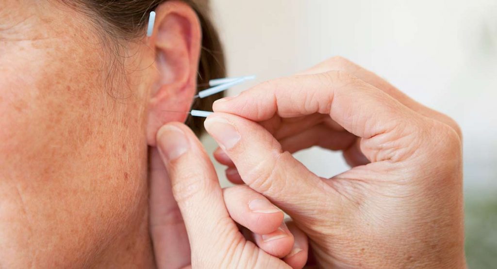 Akkupunktur in Ihrer Hausarztpraxis Oberle Niehues